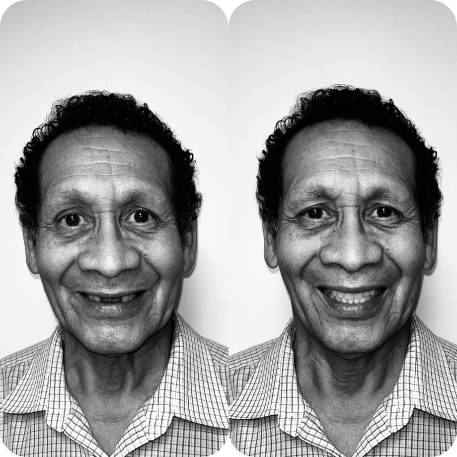 Rehabilitación Bucal
